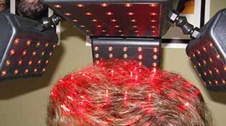 Low level laser  therapy - LLLT
